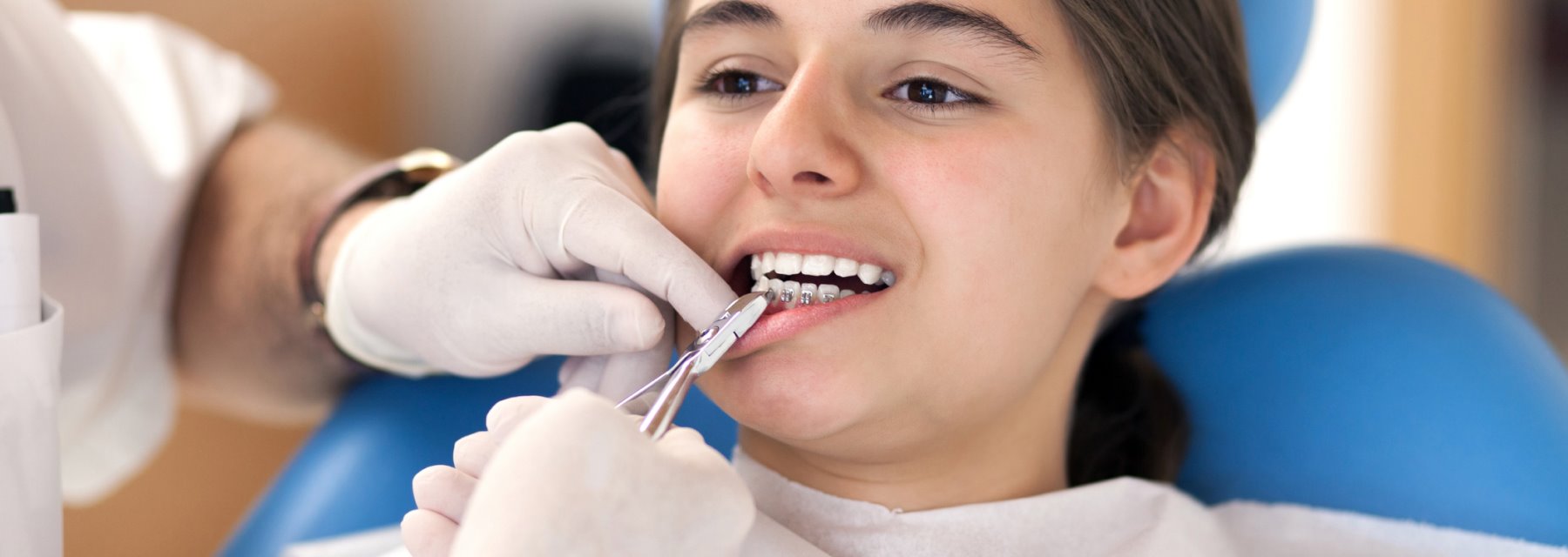 Types of Braces