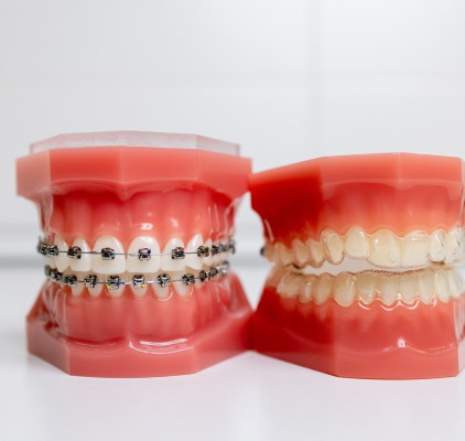 Orthodontic Treatment Columbia | Twaddle Orthodontics